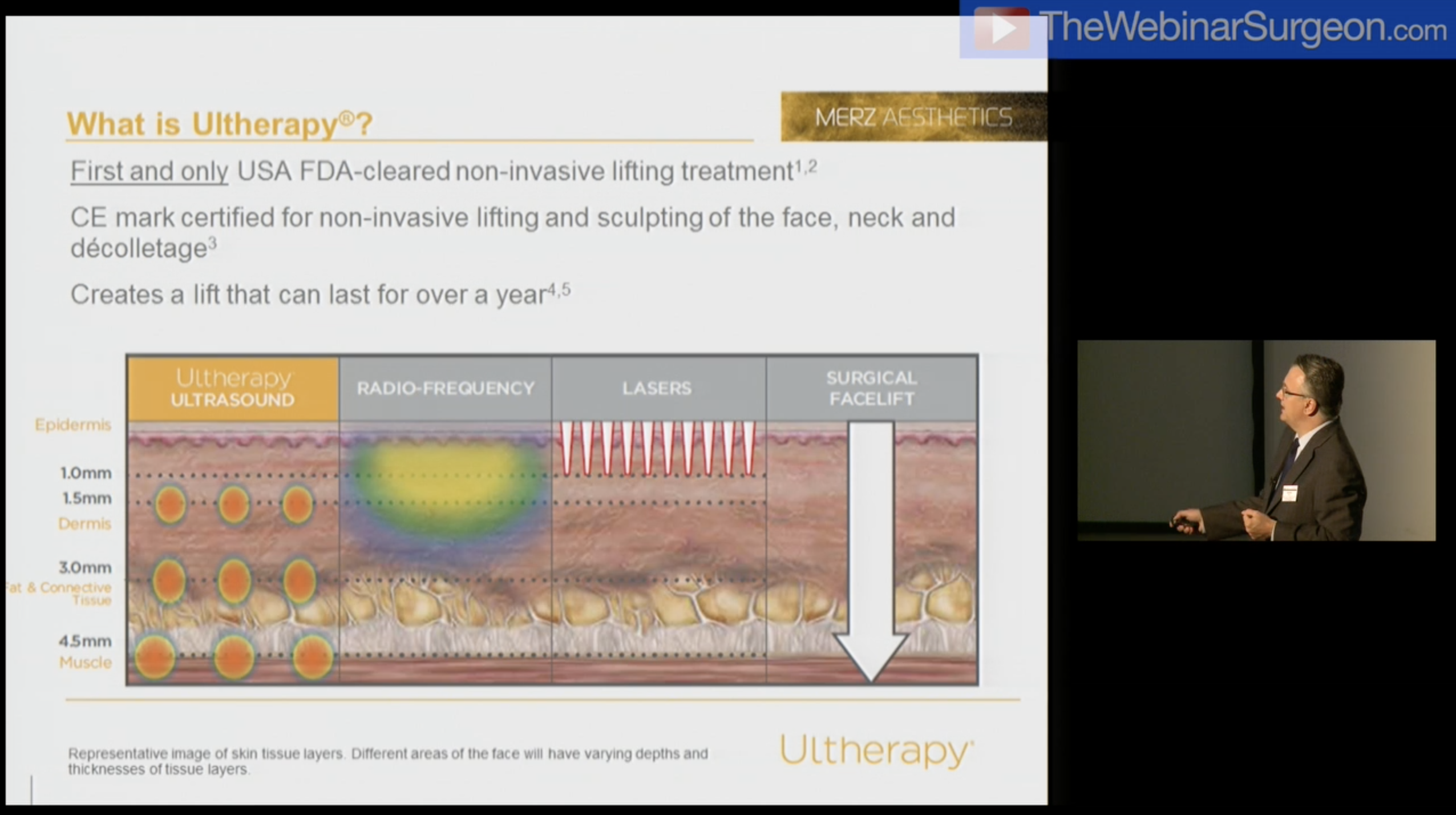 Ultherapy Ultrasound, Matt White