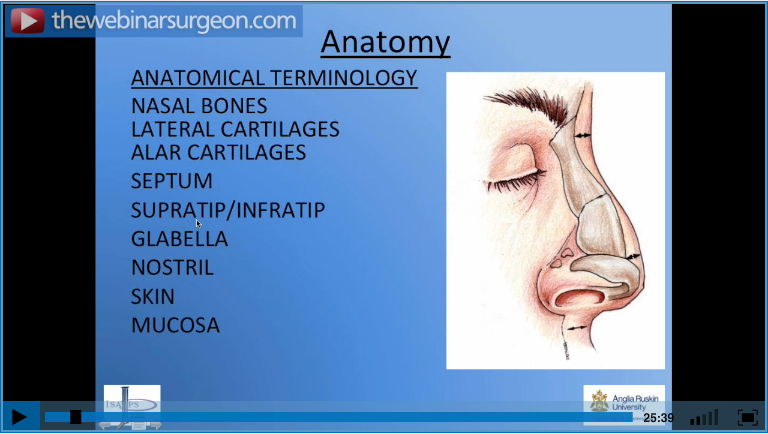 Rhinoplasty