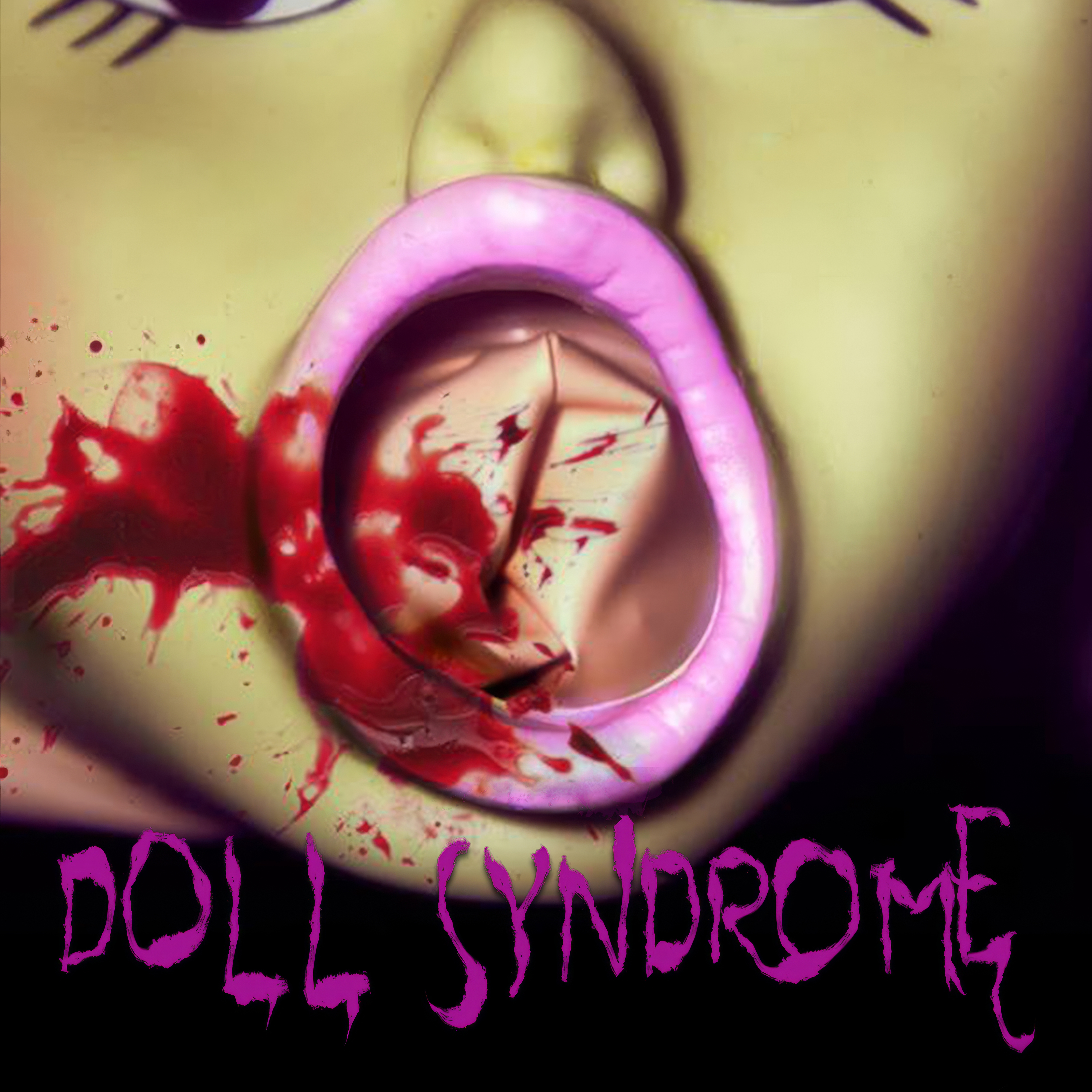 Doll Syndrome