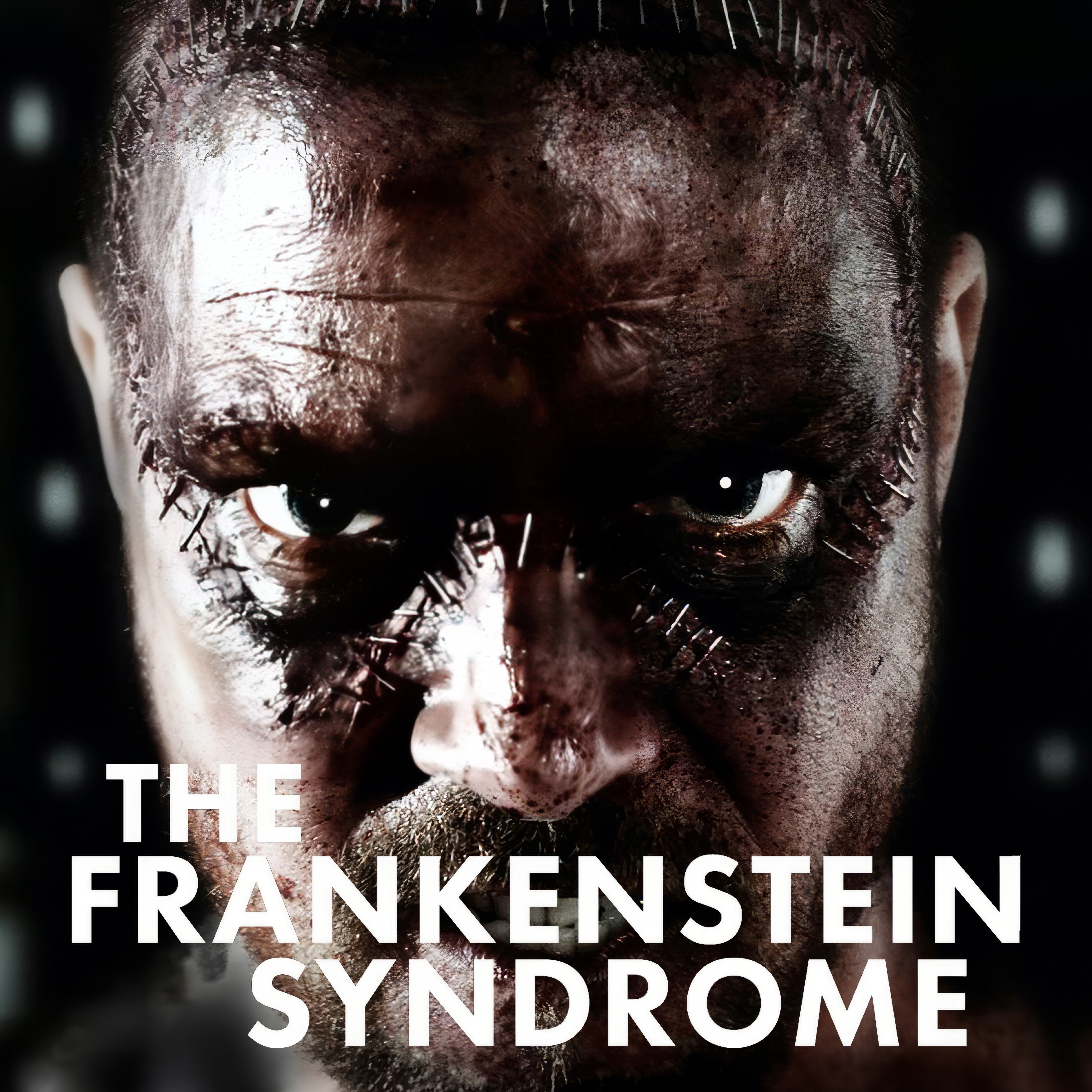 The Frankenstein Syndrome