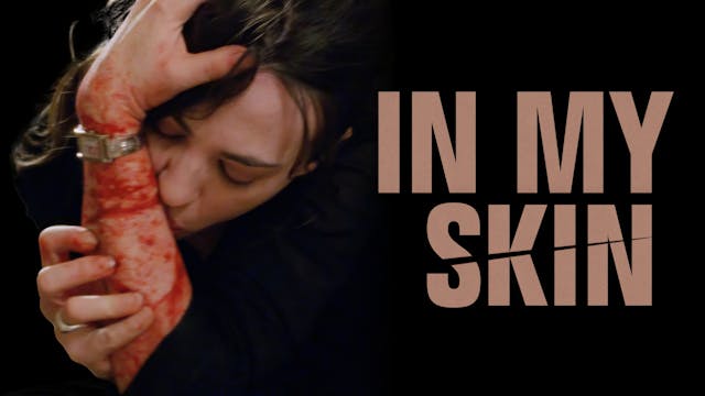 In My Skin