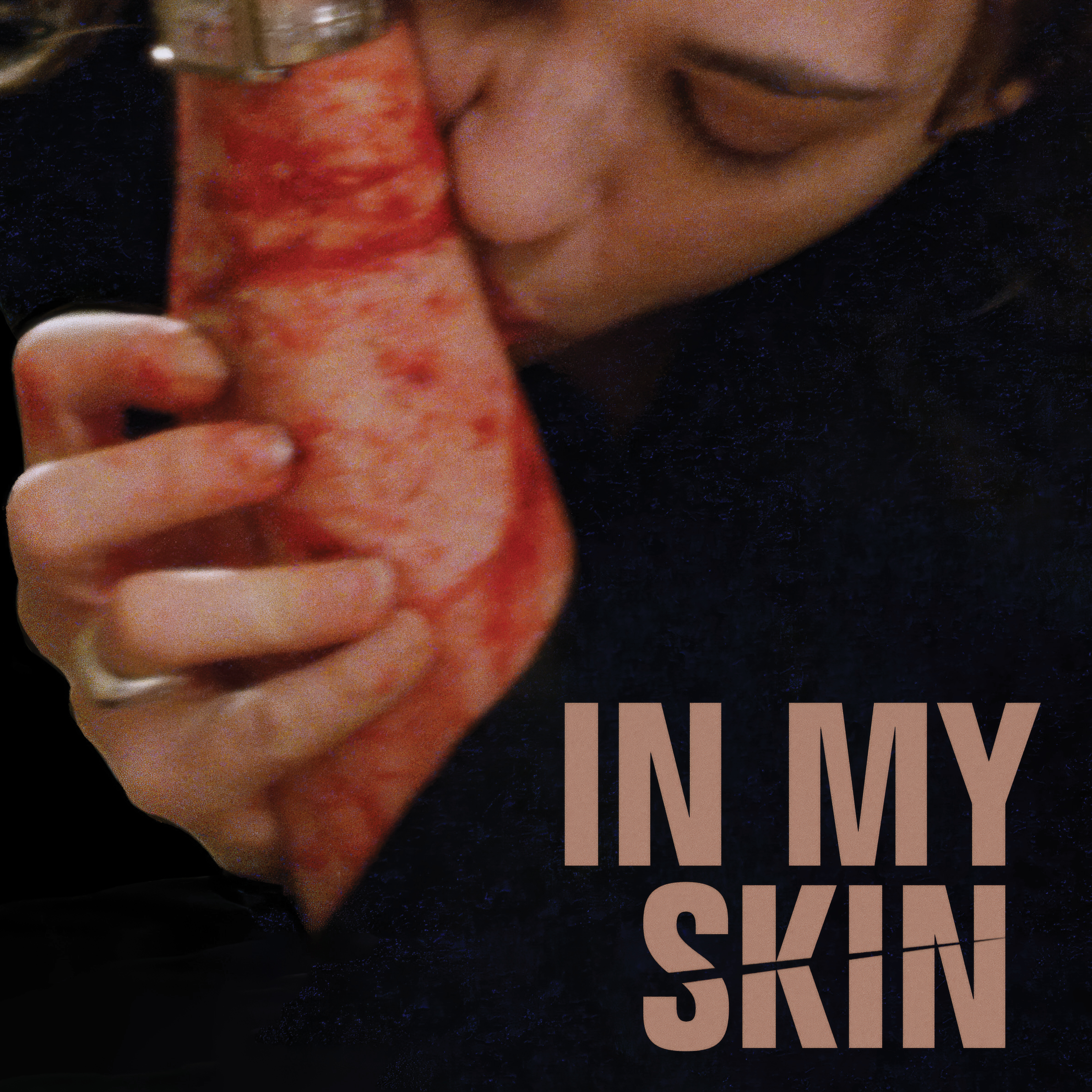 In My Skin
