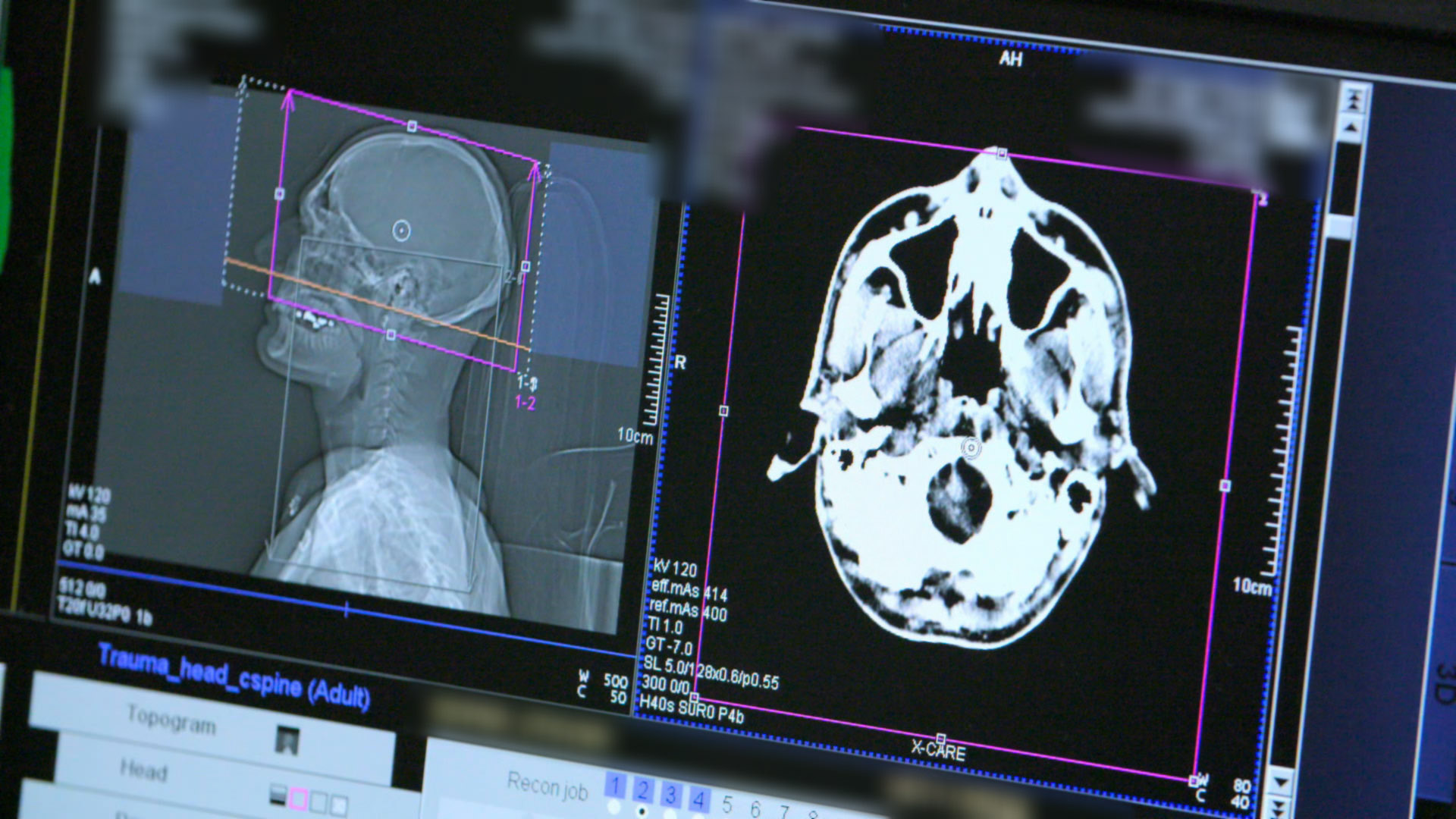 A&E After Dark S4:E1 - Crashed Brand-New Car