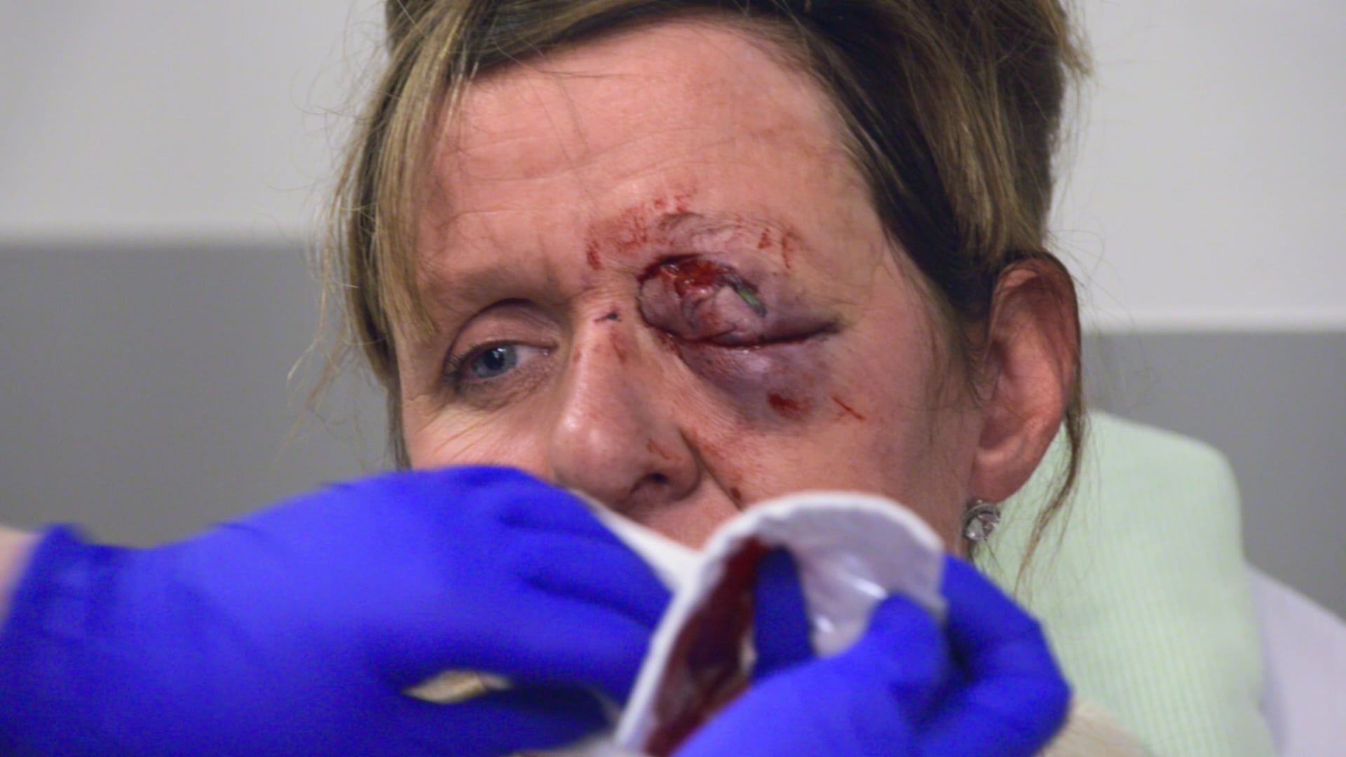 A&E After Dark S3:E3 - Life in their hands