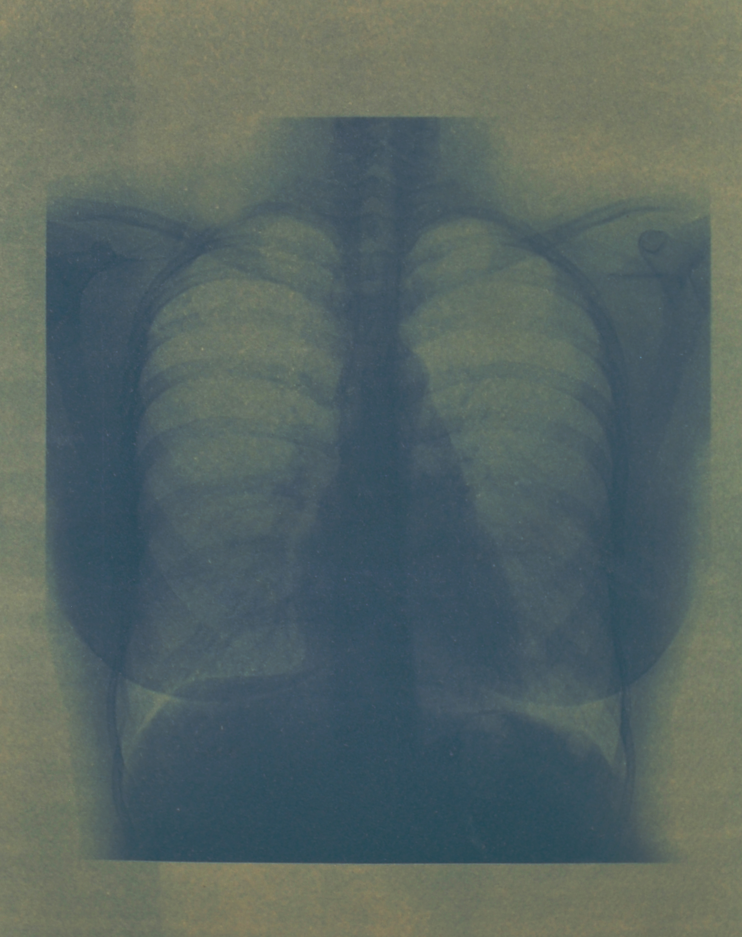 Absence - Cyanotype