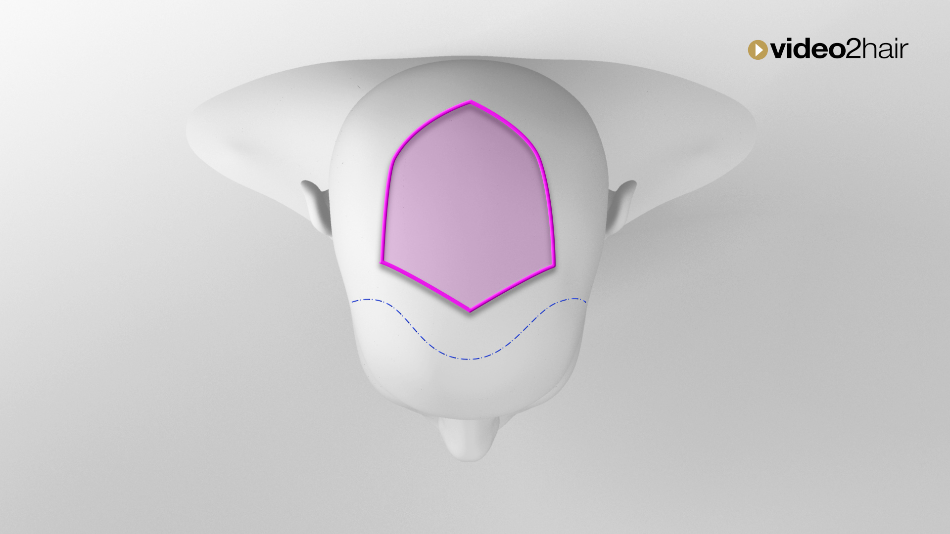 #01 - DIVIDING - LINE graduation