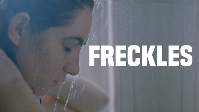 Freckles