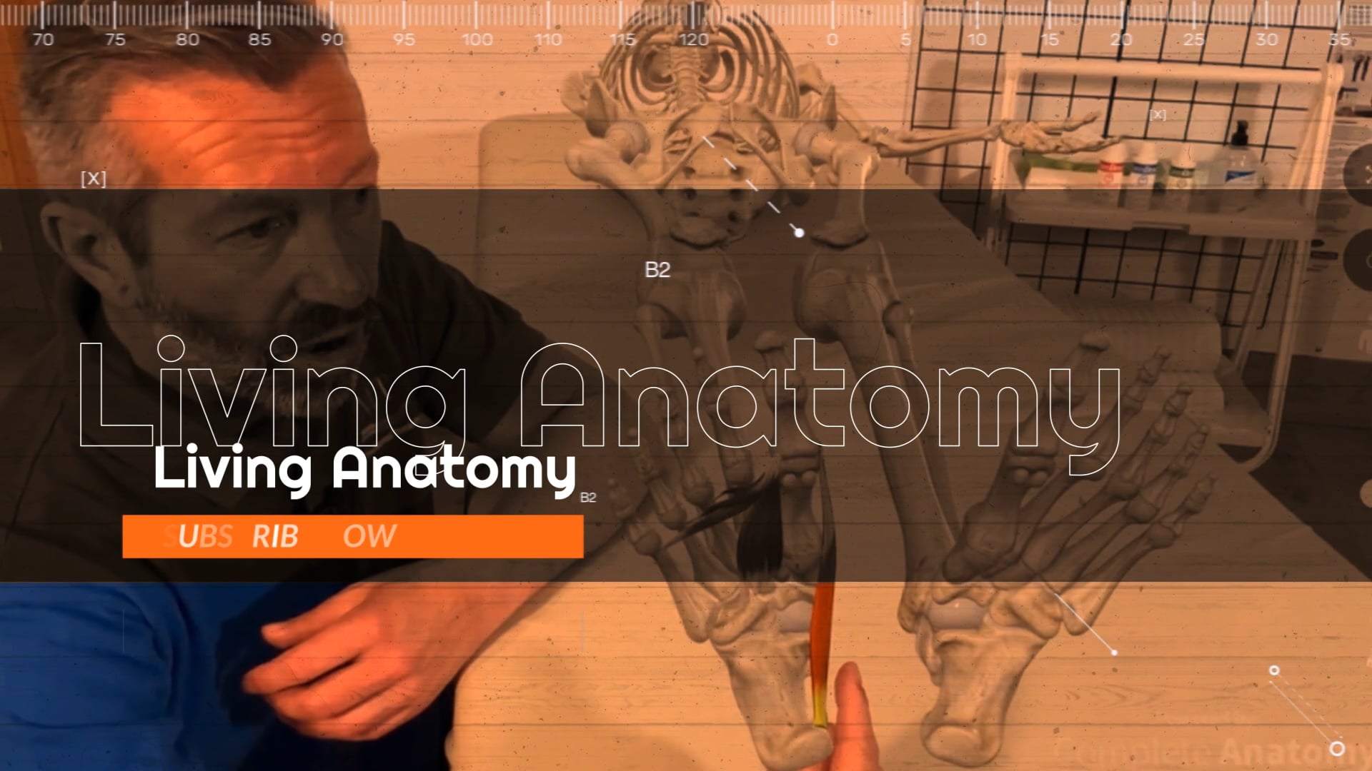 Living Anatomy - Bunions