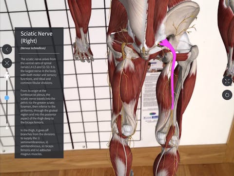 Sciatic nerve pain