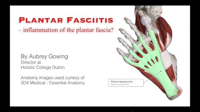 Plantar Fasciitis