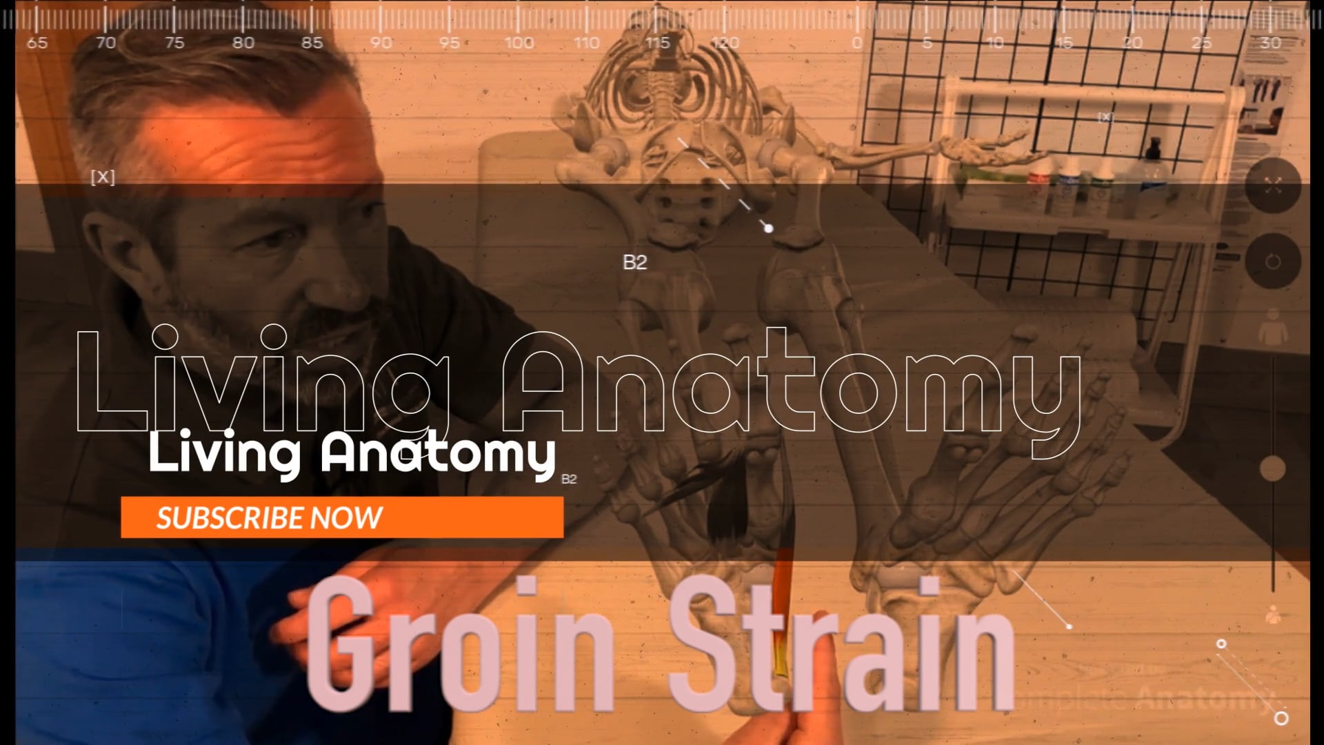 Groin Strain