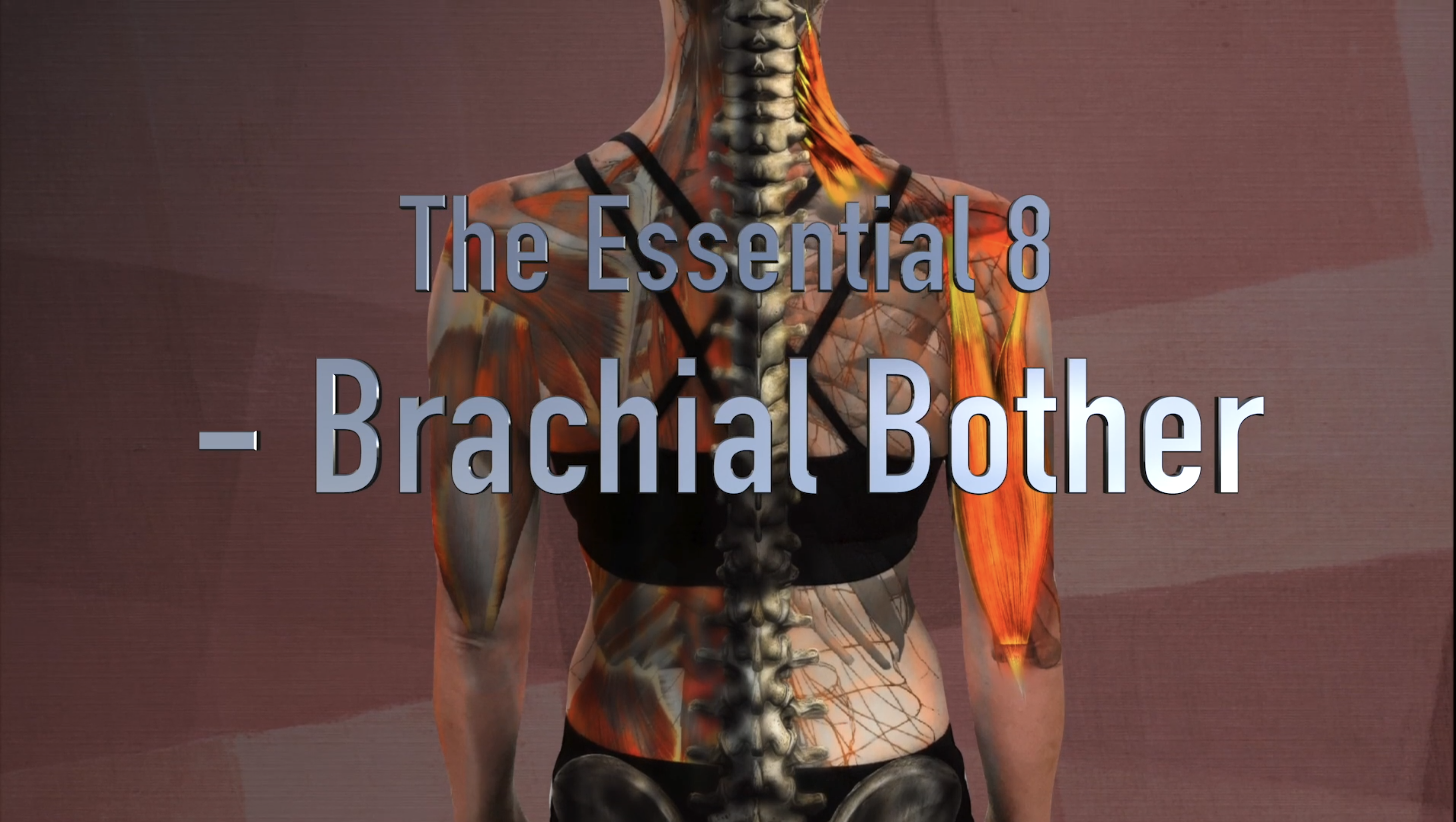Brachial Bother