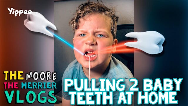 Pulling 2 Baby Teeth At Home!