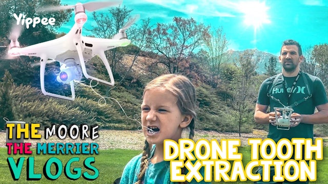 Drone Tooth Extraction - Family Vlog