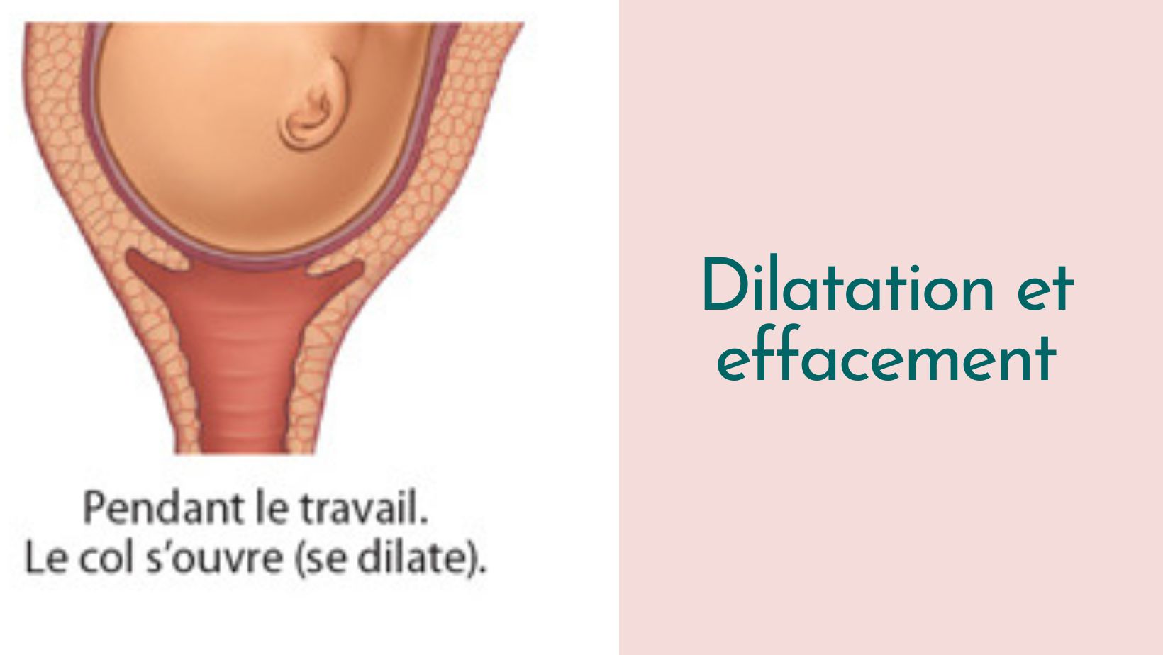 Capsule Doula | Dilatation et effacement