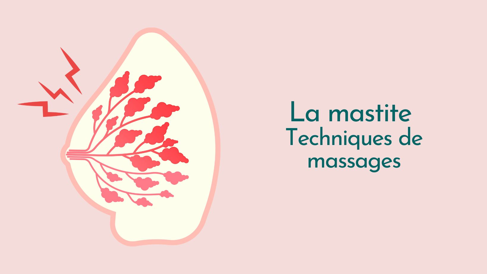 Capsule Doula | La mastite