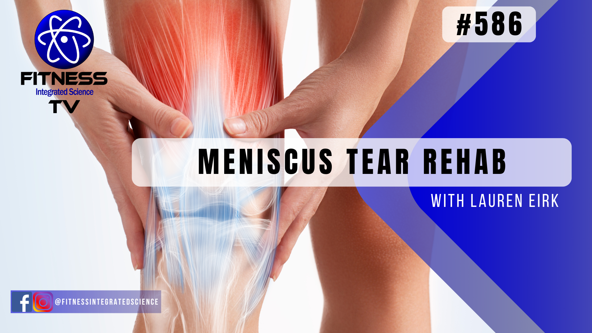Video 586 | Meniscus Tear Rehab (30 minutes) with Lauren Eirk