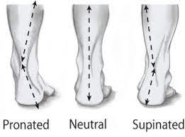 Fix Flat Feet & Eliminate Foot pain