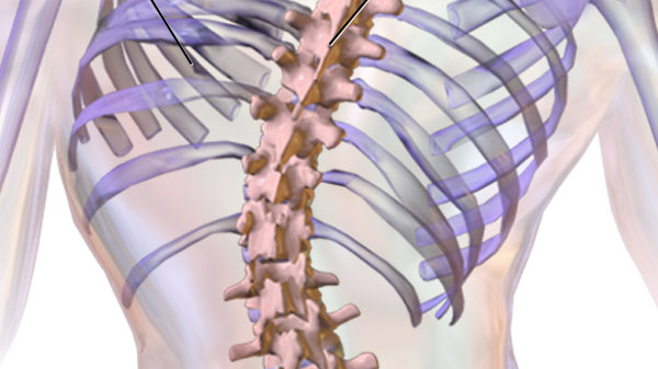Unwinding Scoliosis from the Inside Out