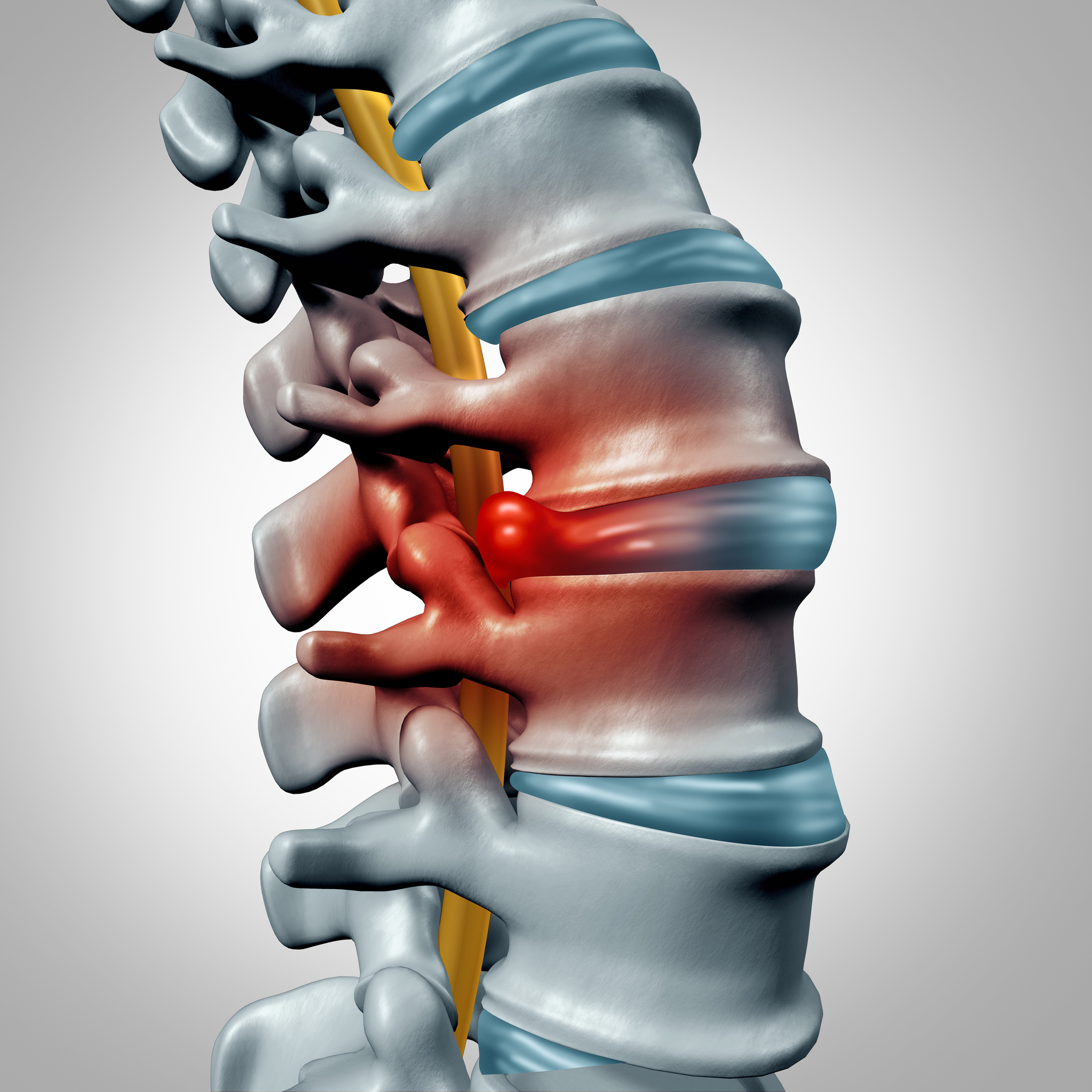Chronic Pain Relief