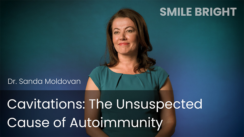 Cavitations - The Unsuspected Cause of Autoimmunity