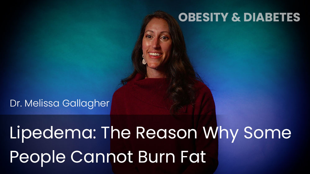 Lipedema - The Reason Why Some People Cannot Burn Fat
